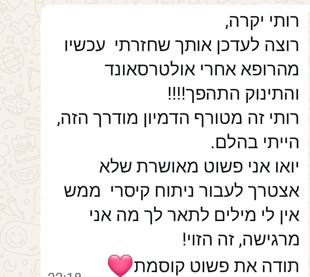 המלצה